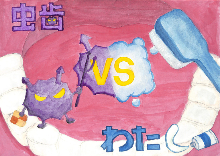 A031 虫歯 vs わたし りお