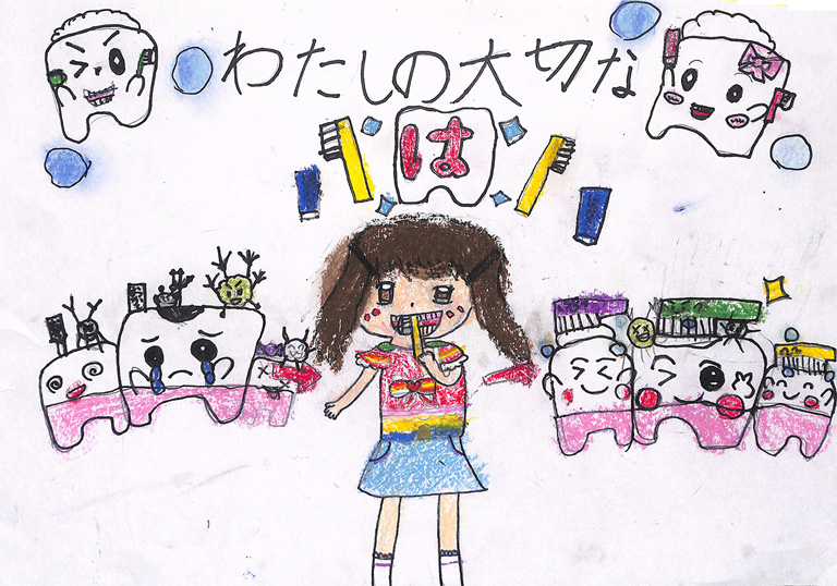 C079 大切な歯 ♡YUINA♡