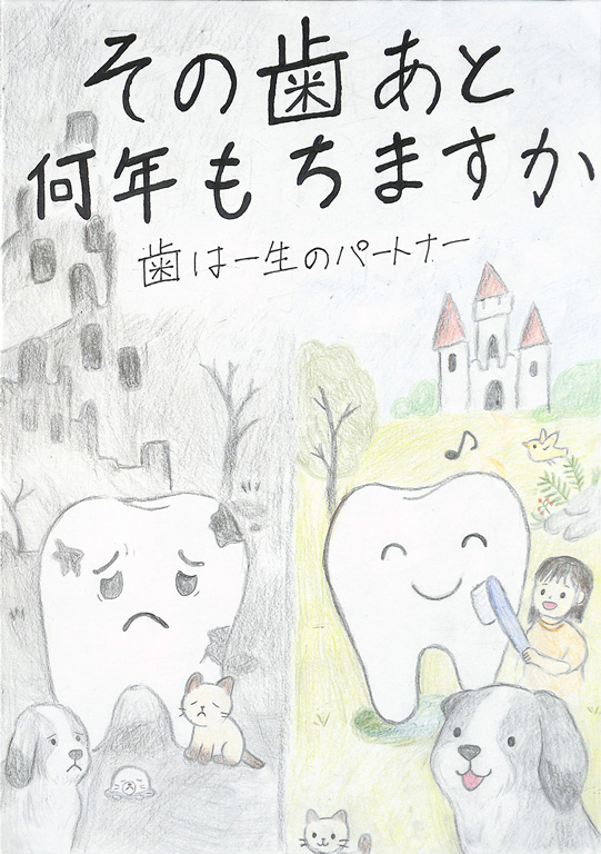 C269 その歯あと何年もちますか？ ミルフィー
