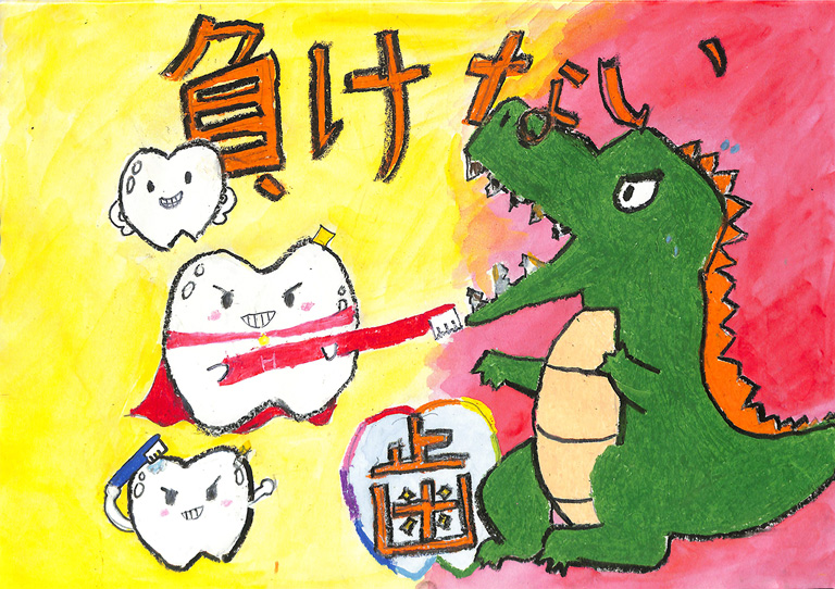 C289 強い歯は負けない！ ゆづぽんず