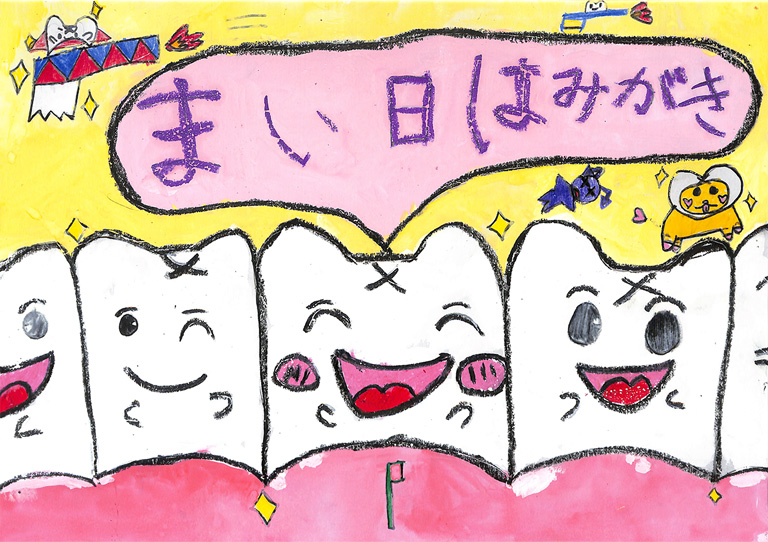 C303 はハ歯がならんでる。 はみね