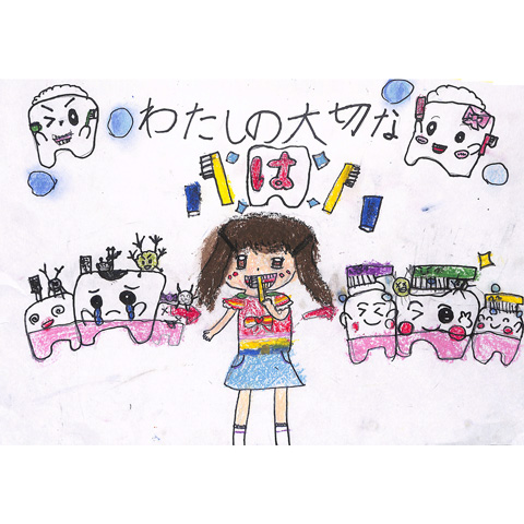C079 大切な歯 ♡YUINA♡