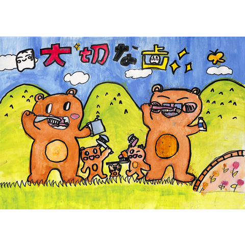 C172 大切な歯 ともちゃん