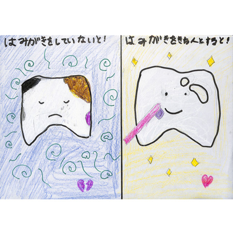 C217 虫歯にならないために つむ