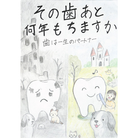 C269 その歯あと何年もちますか？ ミルフィー