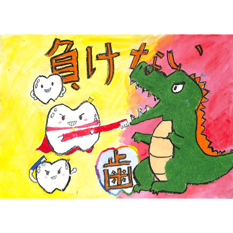 C289 強い歯は負けない！ ゆづぽんず