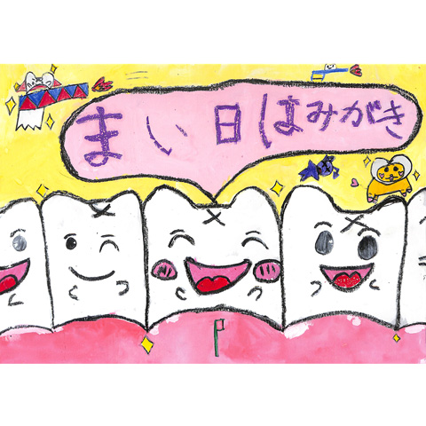 C303 はハ歯がならんでる。 はみね